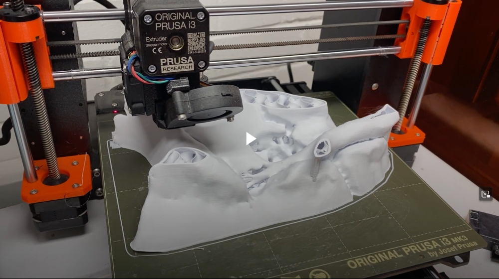 3D-печать и дела сердечные